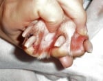 Гъбична инфекция кучешки нокти